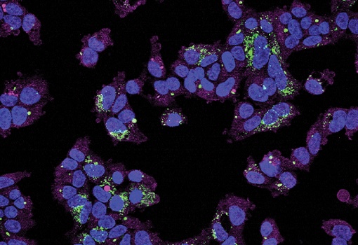 Fluorescence microscopy image of cells showing blue nuclei, magenta structures and green peroxisomes.