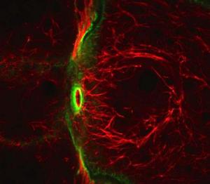This high magnification view of the filaments (in red) made by the newly discovered atypical tropomyosin shows that they do not overlap with actin filaments (in green). 
